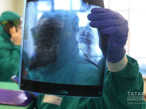 2025 елда 12 лениногорскилыда сулыш органнары туберкулезы авыруы ачыкланган